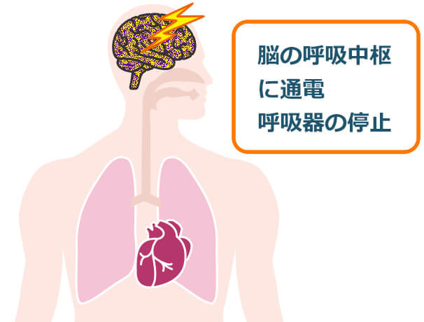 脳の呼吸中枢に通電、呼吸器の停止